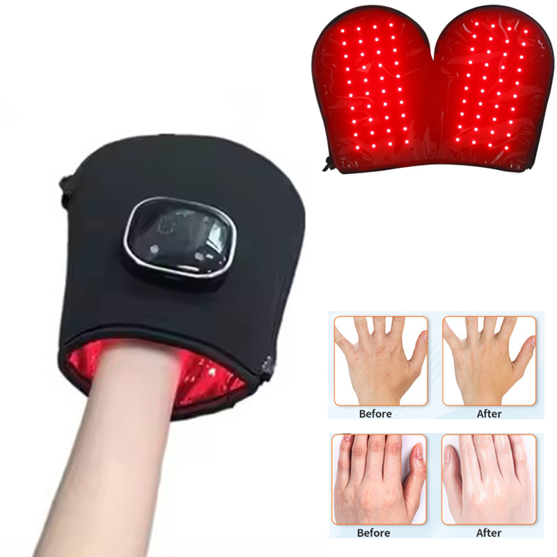 НОВЫЙ Аппарат для светотерапии – обзор и цена Galvanic Skin Sensor